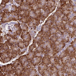 Invitrogen PDIA2 Polyclonal Antibody 100 &mu;L; Unconjugated:Antibodies,