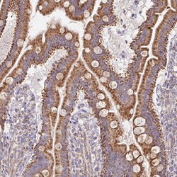 Invitrogen MAVS Polyclonal Antibody 100 &mu;L; Unconjugated:Antibodies,