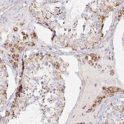 Invitrogen MAVS Polyclonal Antibody 100 &mu;L; Unconjugated:Antibodies,