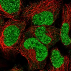 Invitrogen TPI1 Polyclonal Antibody 100 &mu;L; Unconjugated:Antibodies,