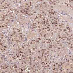 Invitrogen TPI1 Polyclonal Antibody 100 &mu;L; Unconjugated:Antibodies,