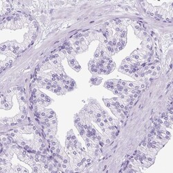 Invitrogen KPNA1 Polyclonal Antibody 100 &mu;L; Unconjugated:Antibodies,