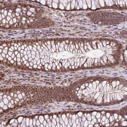Invitrogen KPNA1 Polyclonal Antibody 100 &mu;L; Unconjugated:Antibodies,