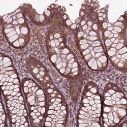 Invitrogen PLCD3 Polyclonal Antibody 100 &mu;L; Unconjugated:Antibodies,