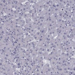 Invitrogen FDXR Polyclonal Antibody 100 &mu;L | Buy Online | Invitrogen&trade; | Fisher Scientific