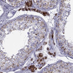 Invitrogen FDXR Polyclonal Antibody 100 &mu;L | Buy Online | Invitrogen&trade; | Fisher Scientific