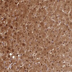 Invitrogen GSTA1 Polyclonal Antibody 100 &mu;L; Unconjugated:Antibodies,