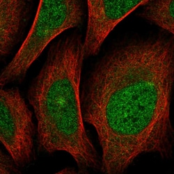 Invitrogen SCN4A Polyclonal Antibody 100 &mu;L | Buy Online | Invitrogen&trade; | Fisher Scientific