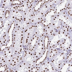 Invitrogen NONO Polyclonal Antibody 100 &mu;L; Unconjugated:Antibodies,