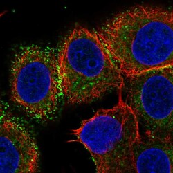 Invitrogen B7-H4 Polyclonal Antibody 100 &mu;L; Unconjugated:Antibodies,