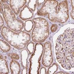Invitrogen MRPL24 Polyclonal Antibody 100 &mu;L; Unconjugated:Antibodies,