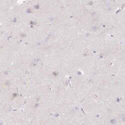 Invitrogen CRISP3 Polyclonal Antibody 100 &mu;L; Unconjugated:Antibodies,
