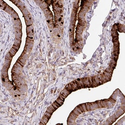 Invitrogen CRISP3 Polyclonal Antibody 100 &mu;L; Unconjugated:Antibodies,
