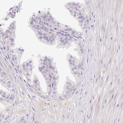 Invitrogen CRISP3 Polyclonal Antibody 100 &mu;L; Unconjugated:Antibodies,