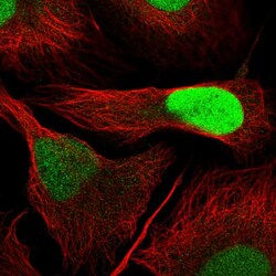 Invitrogen DUT Polyclonal Antibody 100 &mu;L; Unconjugated:Antibodies,