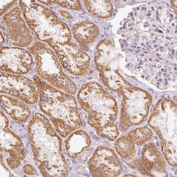 Invitrogen DUT Polyclonal Antibody 100 &mu;L; Unconjugated:Antibodies,