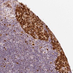 Invitrogen DUT Polyclonal Antibody 100 &mu;L; Unconjugated:Antibodies,