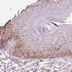 Invitrogen DUT Polyclonal Antibody 100 &mu;L; Unconjugated:Antibodies,
