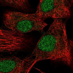 Invitrogen DR4 Polyclonal Antibody 100 &mu;L; Unconjugated:Antibodies,