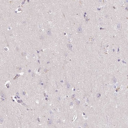 Invitrogen DR4 Polyclonal Antibody 100 &mu;L; Unconjugated:Antibodies,