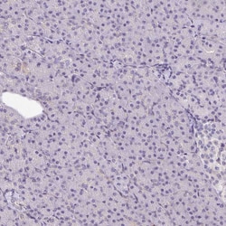Invitrogen DR4 Polyclonal Antibody 100 &mu;L; Unconjugated:Antibodies,