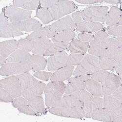 Invitrogen DR4 Polyclonal Antibody 100 &mu;L; Unconjugated:Antibodies,