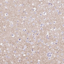 Invitrogen Orexin Receptor 2 Polyclonal Antibody 100 &mu;L; Unconjugated:Antibodies,