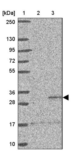 Invitrogen ST8SIA2 Polyclonal Antibody 100 &mu;L; Unconjugated:Antibodies,