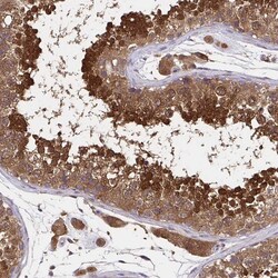 Invitrogen UBE2M Polyclonal Antibody 100 &mu;L; Unconjugated:Antibodies,