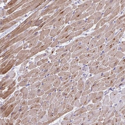Invitrogen p38 MAPK gamma Polyclonal Antibody 100 &mu;L; Unconjugated:Antibodies,