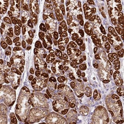 Invitrogen MT-CO2 Polyclonal Antibody 100 &mu;L | Buy Online | Invitrogen&trade; | Fisher Scientific