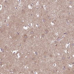 Invitrogen Talin 2 Polyclonal Antibody 100 &mu;L; Unconjugated:Antibodies,
