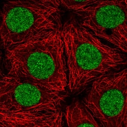 Invitrogen TTF1 Polyclonal Antibody 100 &mu;L; Unconjugated:Antibodies,