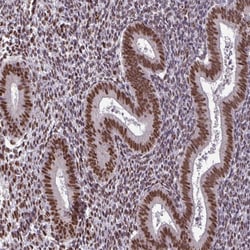 Invitrogen TTF1 Polyclonal Antibody 100 &mu;L; Unconjugated:Antibodies,