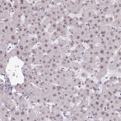 Invitrogen TTF1 Polyclonal Antibody 100 &mu;L; Unconjugated:Antibodies,