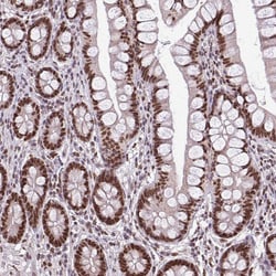 Invitrogen TTF1 Polyclonal Antibody 100 &mu;L; Unconjugated:Antibodies,