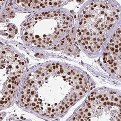 Invitrogen TTF1 Polyclonal Antibody 100 &mu;L; Unconjugated:Antibodies,