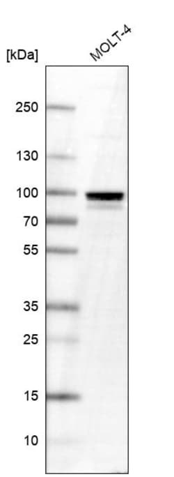 Invitrogen TTF1 Polyclonal Antibody 100 &mu;L; Unconjugated:Antibodies,