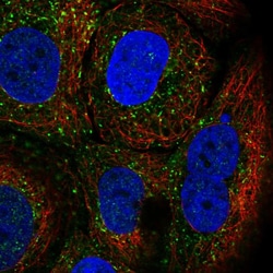 Invitrogen TRIM17 Polyclonal Antibody 100 &mu;L; Unconjugated:Antibodies,