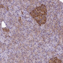 Invitrogen TRIM17 Polyclonal Antibody 100 &mu;L; Unconjugated:Antibodies,