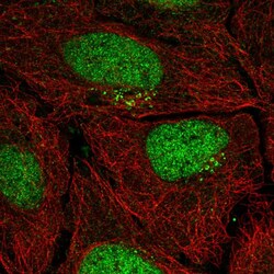 Invitrogen PPP1R1C Polyclonal Antibody 100 &mu;L; Unconjugated:Antibodies,