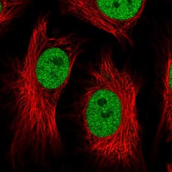Invitrogen ATF1 Polyclonal Antibody 100 &mu;L; Unconjugated:Antibodies,