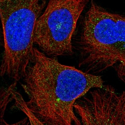 Invitrogen GPR162 Polyclonal Antibody 100 &mu;L; Unconjugated:Antibodies,