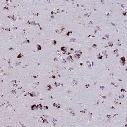 Invitrogen GPR162 Polyclonal Antibody 100 &mu;L; Unconjugated:Antibodies,
