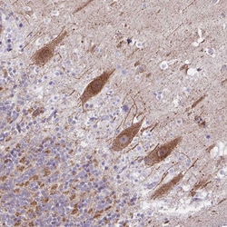 Invitrogen NDUFS2 Polyclonal Antibody 100 &mu;L; Unconjugated:Antibodies,