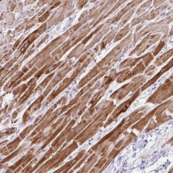 Invitrogen NDUFS2 Polyclonal Antibody 100 &mu;L; Unconjugated:Antibodies,