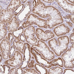 Invitrogen NDUFS2 Polyclonal Antibody 100 &mu;L; Unconjugated:Antibodies,
