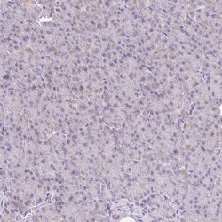 Invitrogen NDUFS2 Polyclonal Antibody 100 &mu;L; Unconjugated:Antibodies,