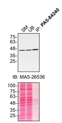 Invitrogen NDUFS2 Polyclonal Antibody 100 &mu;L; Unconjugated:Antibodies,