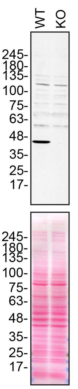Invitrogen NDUFS2 Polyclonal Antibody 100 &mu;L; Unconjugated:Antibodies,